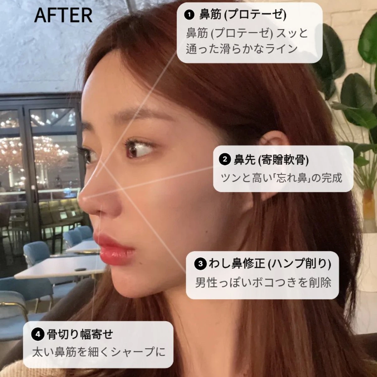 ティアナ整形外科ㅣ1：1 医師相談